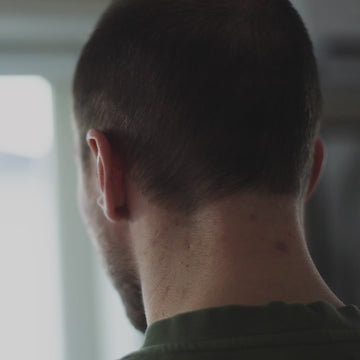 hair growth oil, hårvekst, miste håret, bedre hårvekst, raskere hårvekstens, stimulere hårvekst, øke hårvekst, mot hårtap, hårtap, hårtap menn, hårtap kvinner, håravfall, produkt hårtap, produkt hårvekst, produkt håravfall, hair growth serum, hair loss oil, hair loss serum, hårvekstprodukt, hårtap løsning, tykkere hår, prevent hair loss, beste produkt mot håravfall, tynt hår, hårolje, hårolje hårvekst, hårolje vekst, olje hårvekst, håravfall menn, håravfall kvinner, hair growth